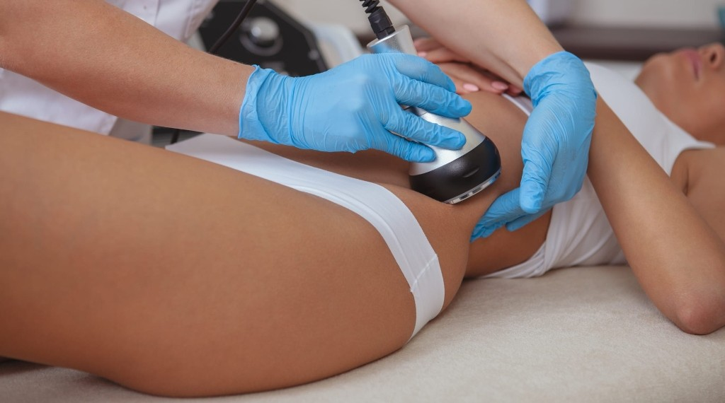 Do Cavitation Machines Work? - Suerbeaty