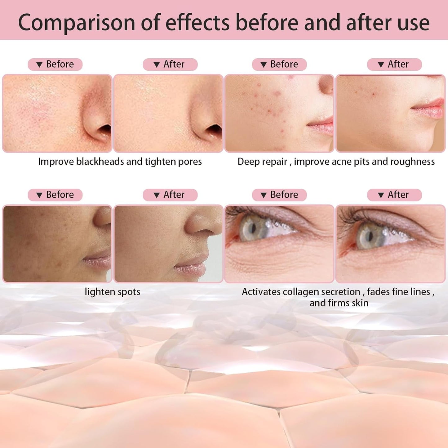 RUTAWZ LED Face Mask Light Therapy Skin Beauty Machine, 7 Color LED Light Therapy Facial Skin Care Mask, Face Mask for Removal Wrinkle Anti Aging Anti-Acne with Face