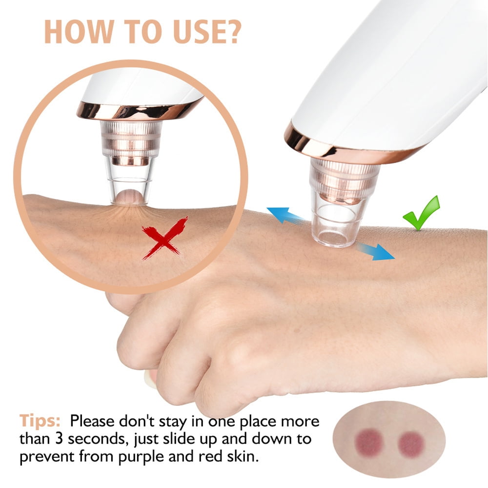 RUTAWZ Blackhead Remover Pore Vacuum Cleaner Pimple Extractor, Facial Pore Cleaner Pore Extractor, Electric USB Pore Vacuum with 5 Probes, Blackhead Suction Tool, Blackhead Remover Kit