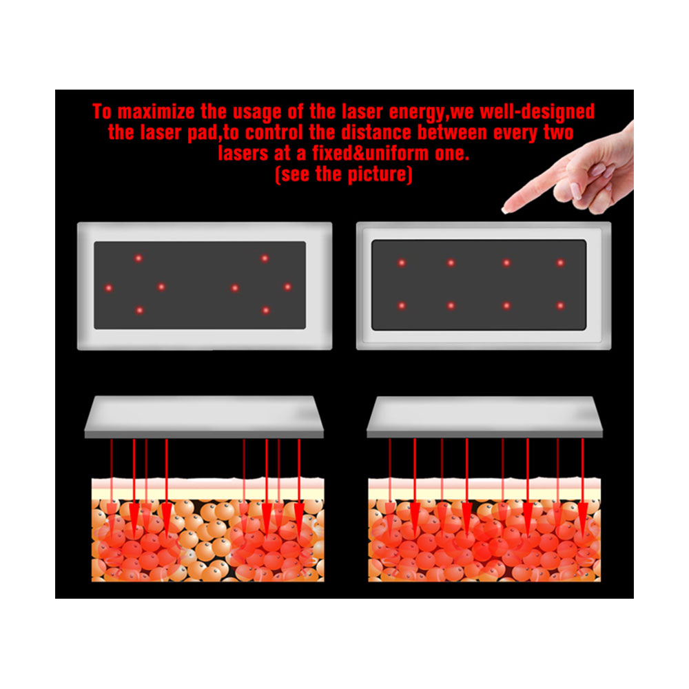 Professional 635nm-650nm Anti-cellulite LED Laser 10 Pads Anti Cellulite Machine