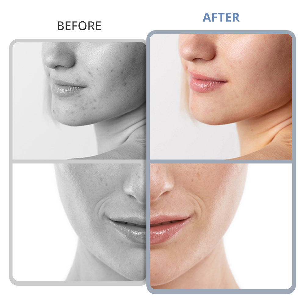 3 In 1 Diamond Microdermabrasion Machine For Exfoliation, Cleansing, Hydration