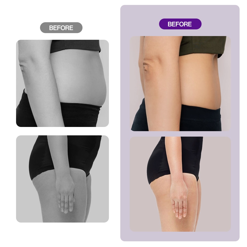 Professional 9-in-1 40k Lipo Cavitation Machine For Body Sculpting & Facial Care