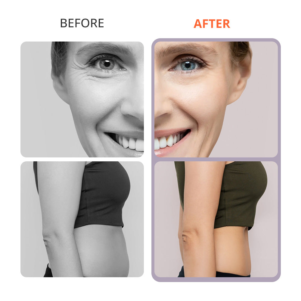 Aristorm S-SHAPE 30K Cavitación Machine, Body Massage Machine Body Massage Facial Skin Care for Beauty Salon Spa for Anti Cellulite Skin Tightening Wrinkle Removal