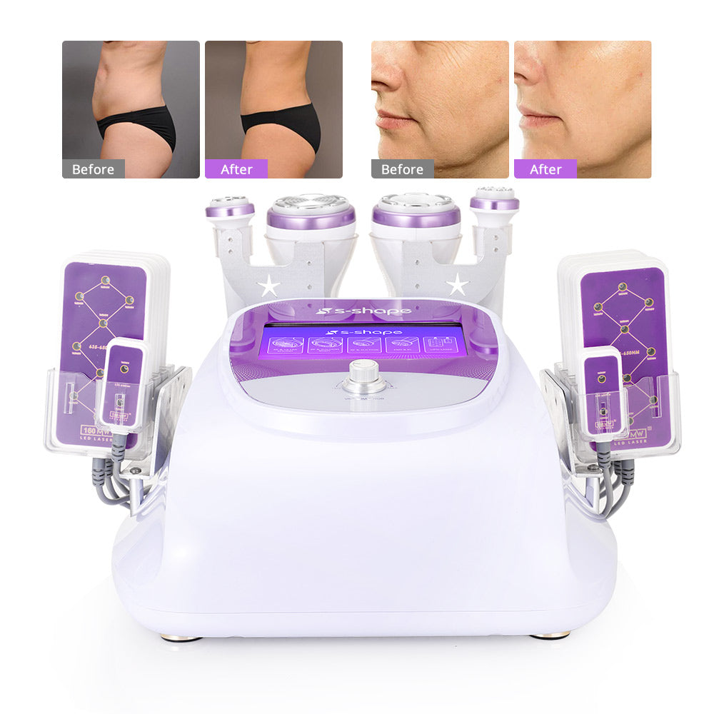 New 30K Cavitation S Shape Machine with 160MW Lipo Laser