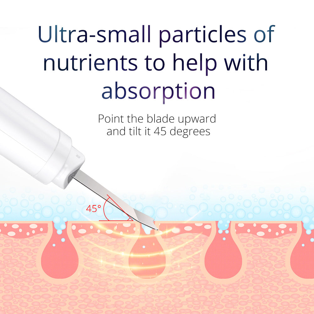 Handheld Ultrasonic Skin Scrubber Ion Device Lifting Tightening Cleaning - Suerbeaty