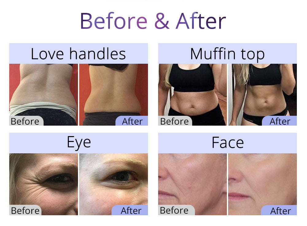 New Ultrasonic 8 In 1 40K Cavitation Body Sculpting Facial Lifting Tightening Spa Machine - Suerbeaty