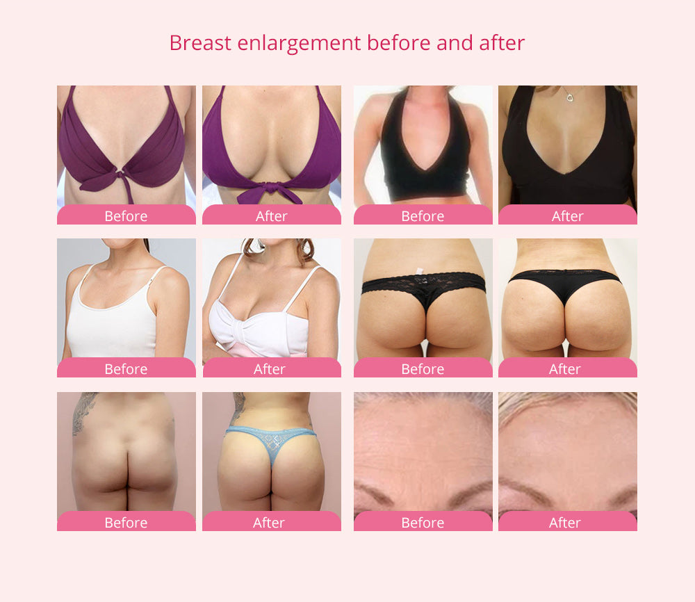 S Curve Suck-Lipo Breast Enhancement Breast Lifting Lipo Laser Slimming Machine - Suerbeaty