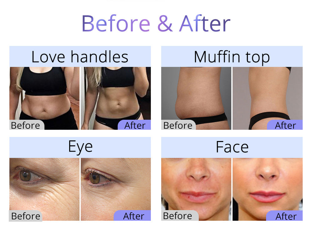 9 IN 1 Cavitation 2.5 Ultrasonic 40K RF Ultrasound Skin Care Lifting Body Slimming Cellulite Reduction Machine - Suerbeaty
