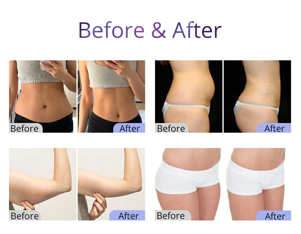 New Cavitation 2.5 Body Fat Removal 40K Cavitation Machine Beauty Machine For Home Use
