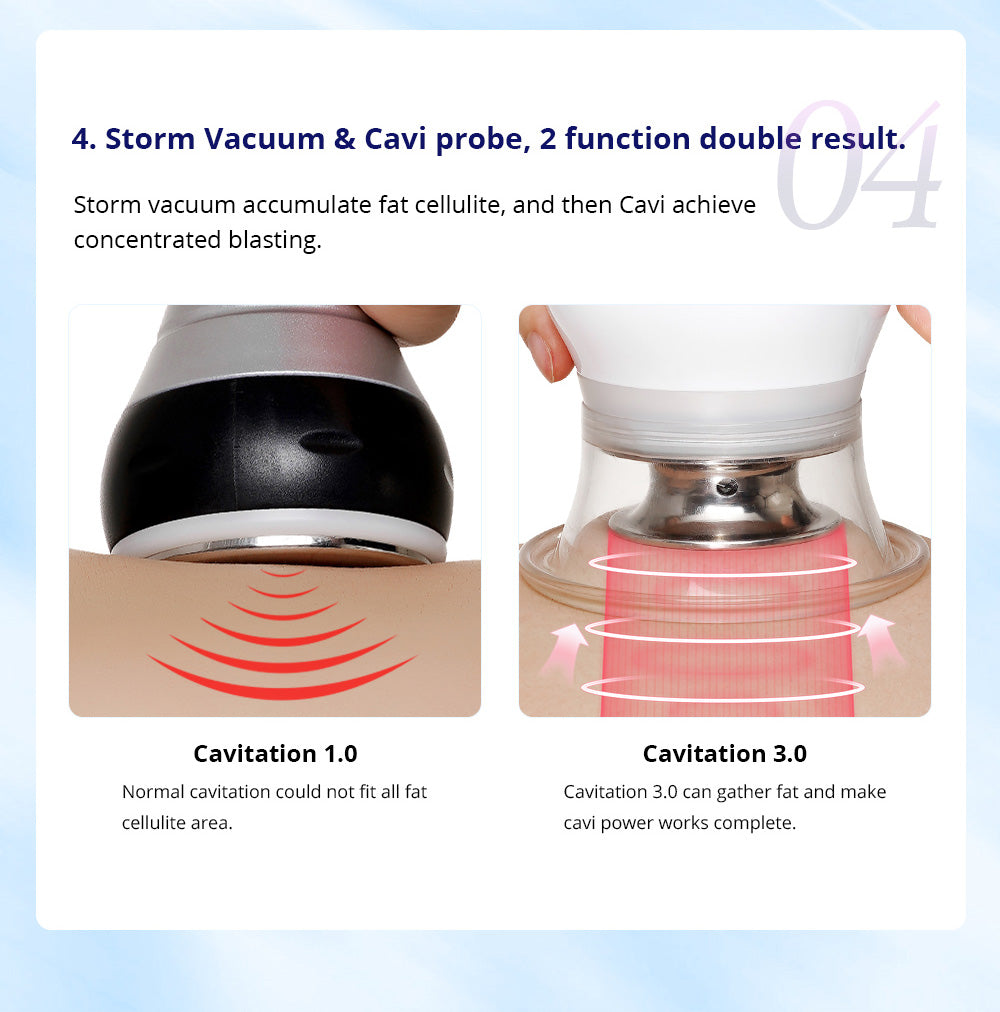 ultrasonic cavitation beauty device