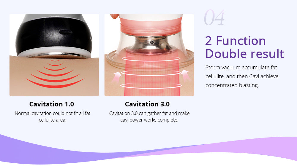 fat cavitation realself