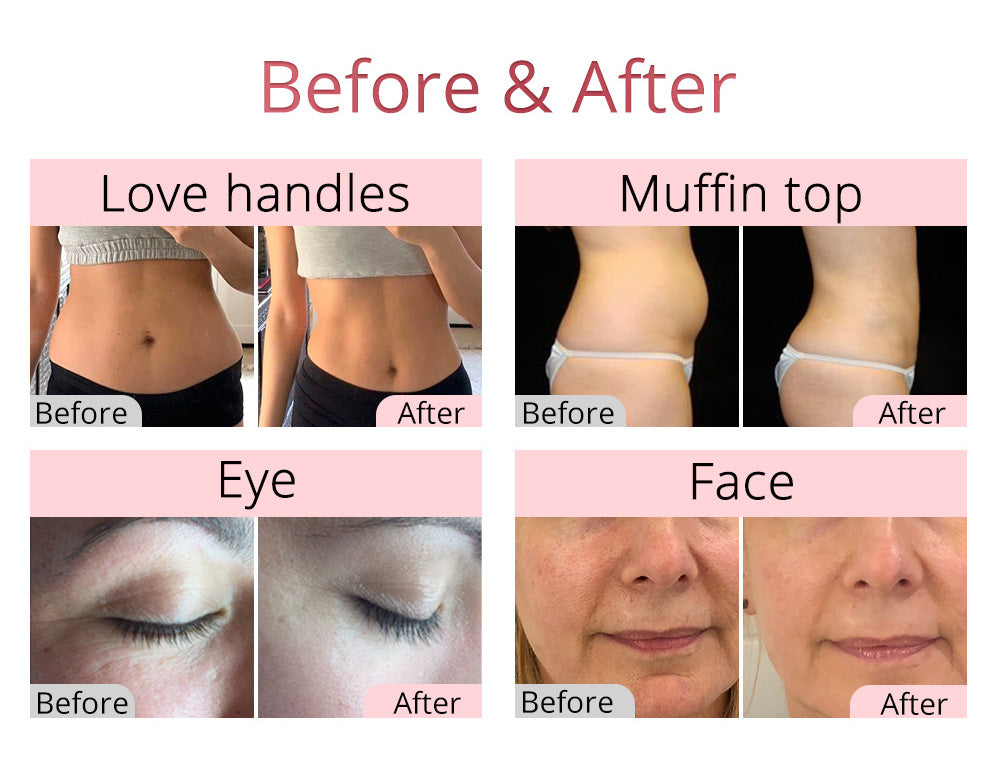 New Arrival 40k Cavitation 2.5 Weight Loss Rf Radio Frequency Skin Tightening Machine - Suerbeaty