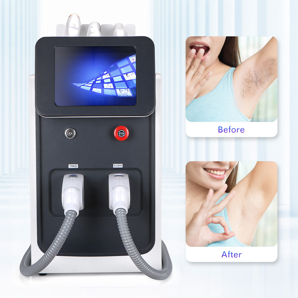 Professional  3 In 1 SHR Elight IPL Permanent Hair Removal YAG Laser Tattoo Remove SPA Beauty Device - Suerbeaty