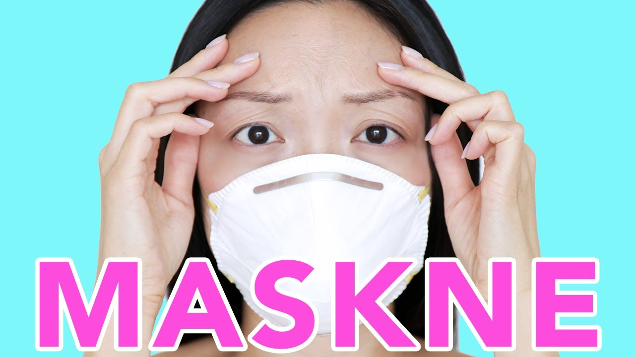 How To Treat Maskne? - Suerbeaty