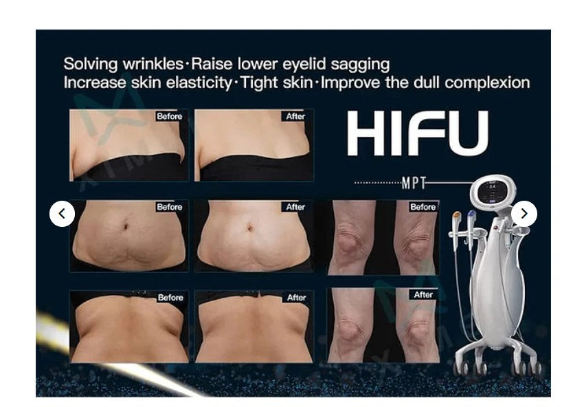 Ultraformer MPT HIFU Machine for Sale