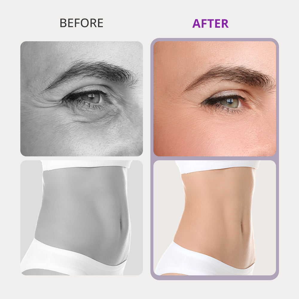 10In1 Ultrasonic Cavitation Slimming Radio Frequency Vacuum Photon Bio Microcurrent LipoLaser Shaping Machine
