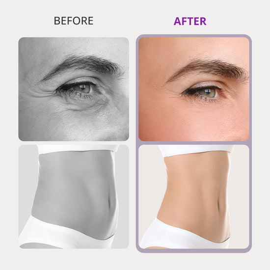 10In1 Ultrasonic Cavitation Slimming Radio Frequency Vacuum Photon Bio Microcurrent LipoLaser Shaping Machine