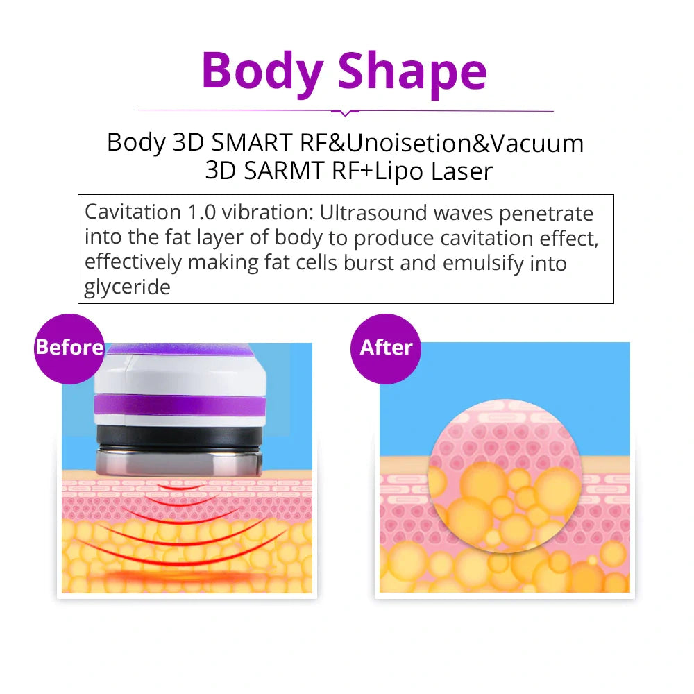 6In1 40K Cavitation Vacuum Weight Loss Radio Frequency Slim Beauty Machine