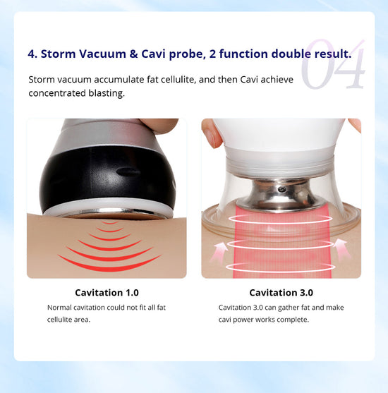 ultrasonic cavitation beauty device