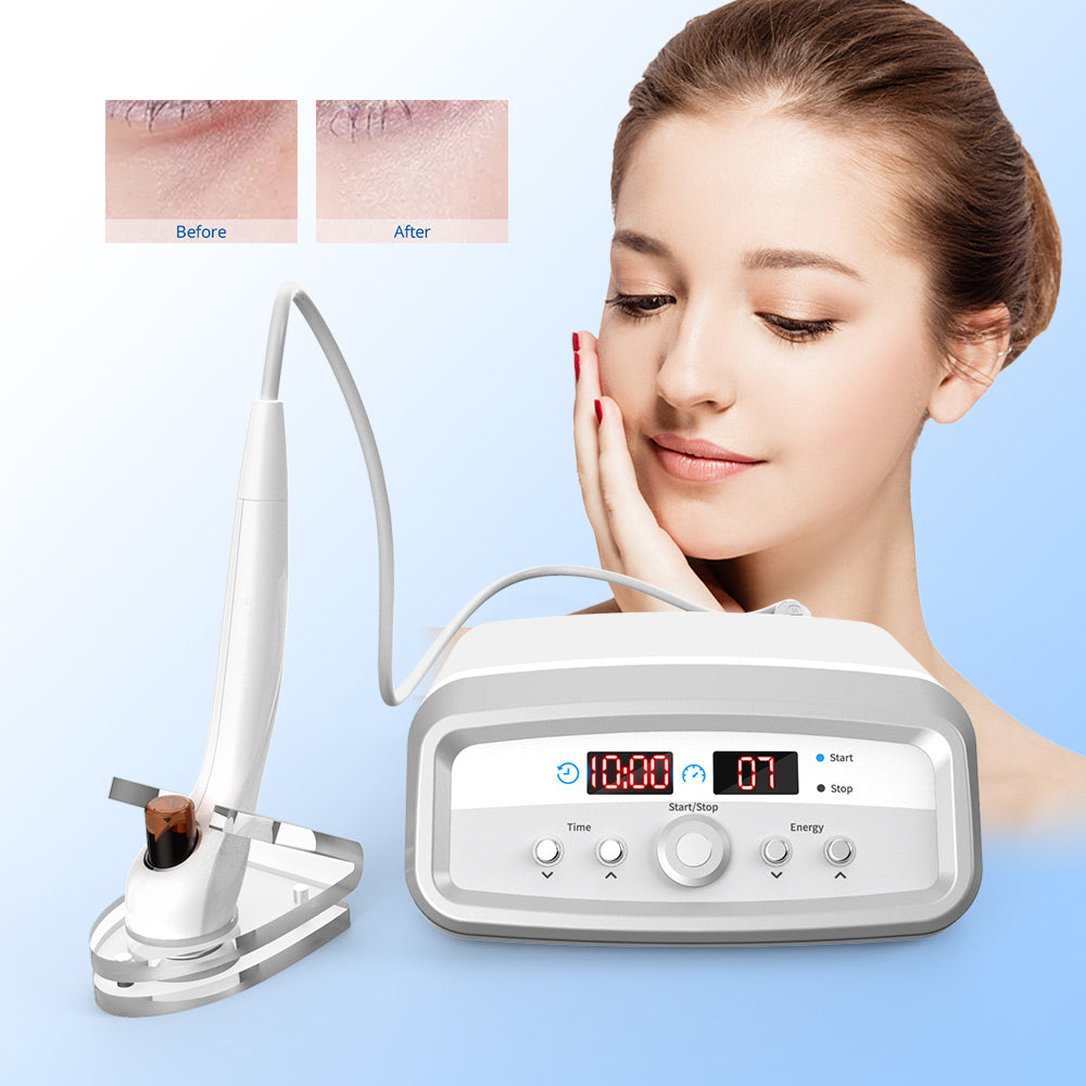 Mini Radio Frequency RF Machine 1 Probes For Face And Body Skin Rejuvenation - Suerbeaty