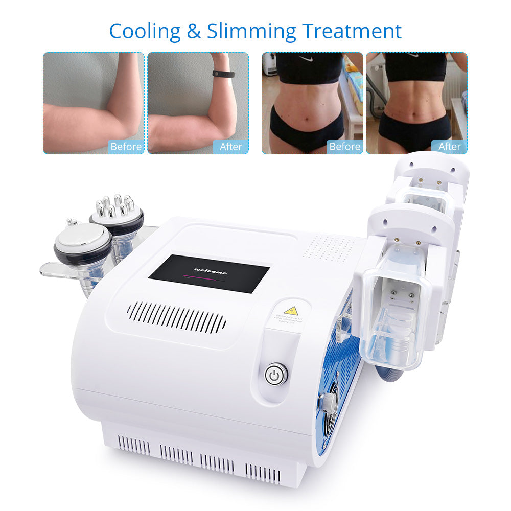 Double Handles Cooling Systerm Cavitation RF Slimming Cellulite Removal Machine - Suerbeaty